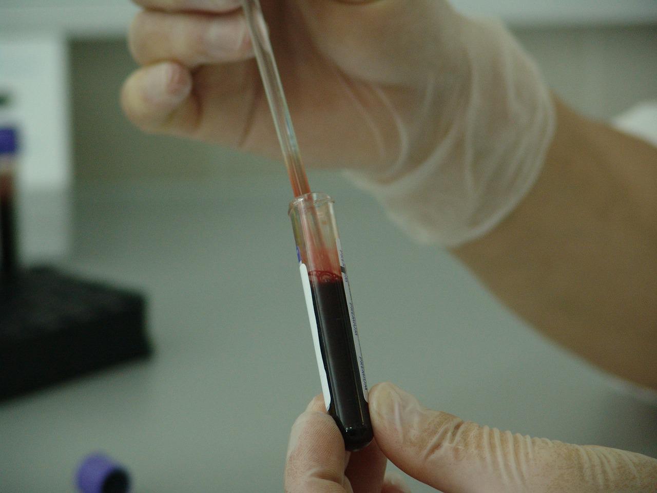 gloved hands with a test tube of blood