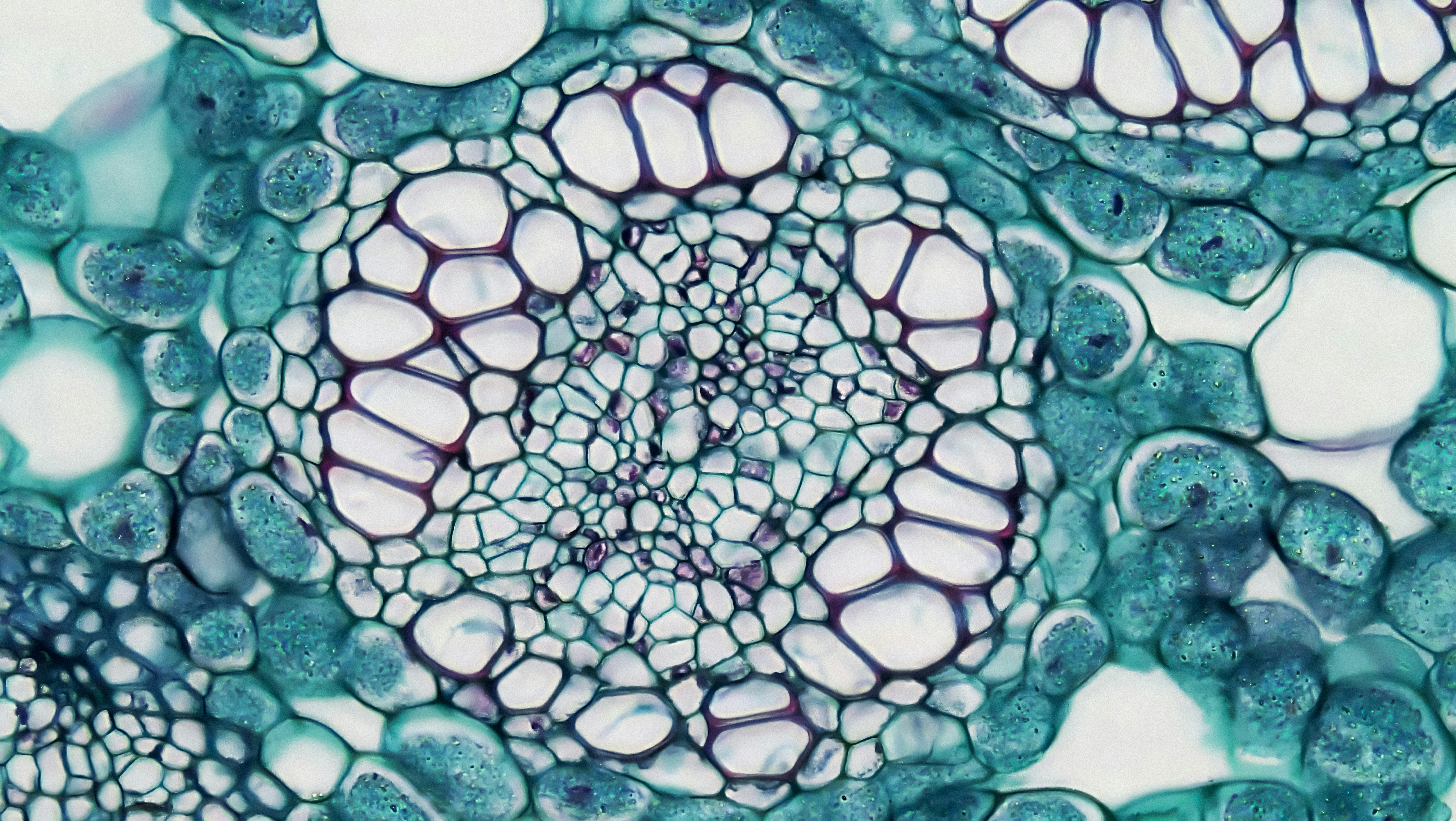 Perennial Monocot Stem: Amphivasal Vascular Bundle in Acorus Rhizome cross section