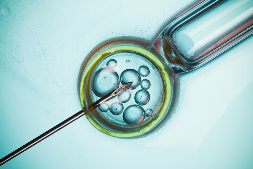 An IVF graphic