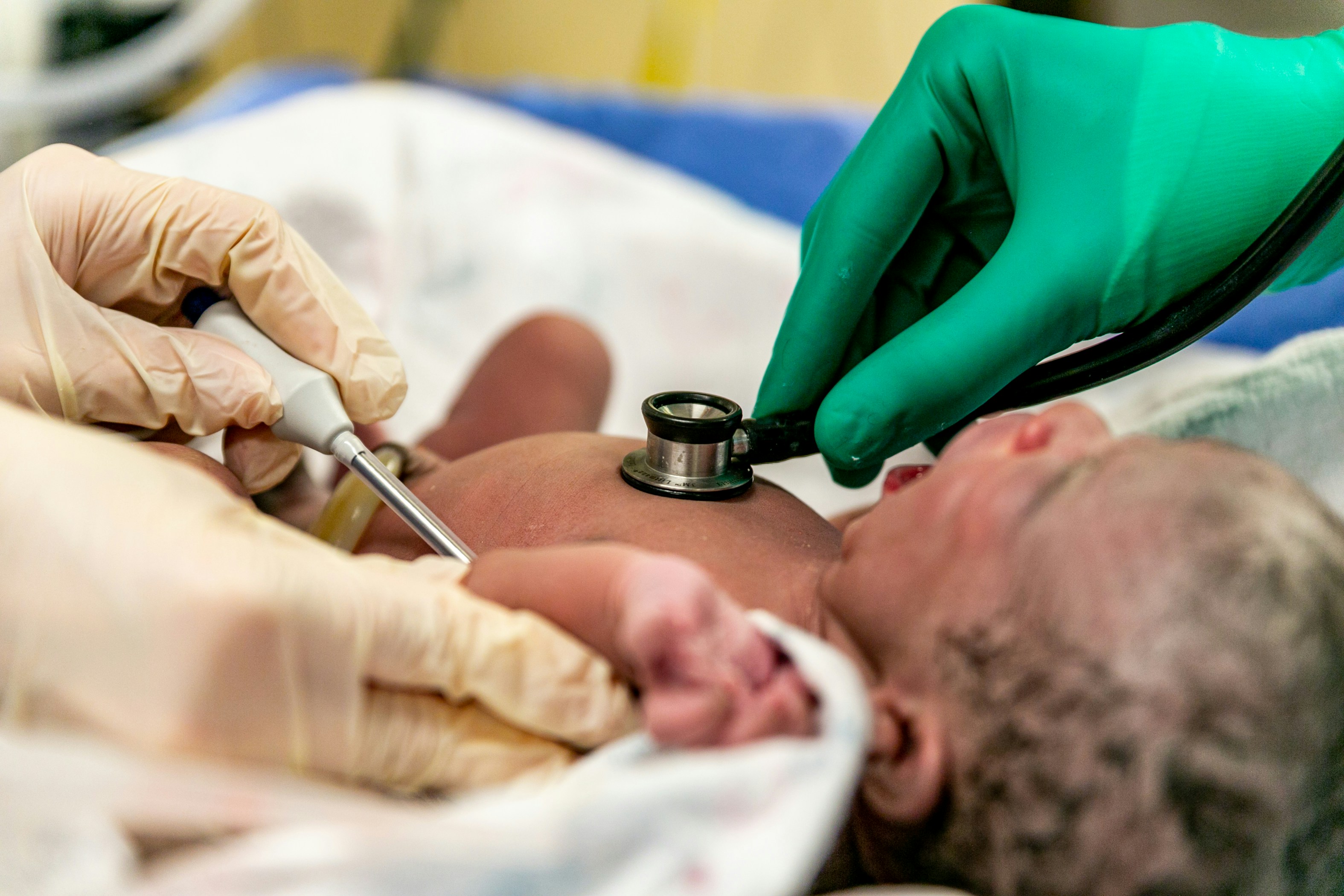 baby being checked with a stethoscope