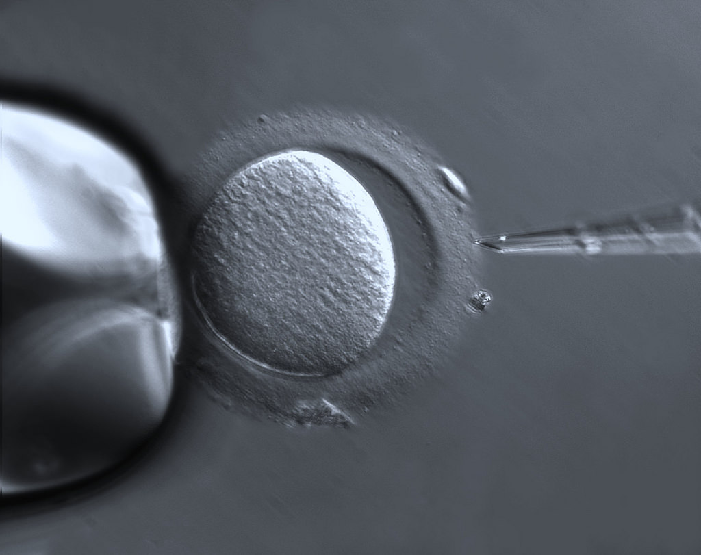 Microscopic image of an egg being fertilized by IVF.
