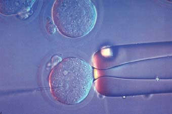 Microscopic image of intracytoplasmic sperm injection