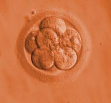 a clump of 6 cells within a circular sac-like structure - all in orange 
