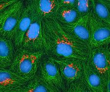 Microscope images of HeLa cells colored in green and blue