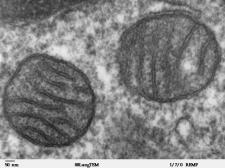 2 mitochondria in grayscale