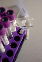 Bird's eye view of test tube rack filled with test tubes.