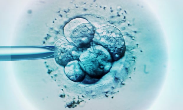 Embryo selection for IVF