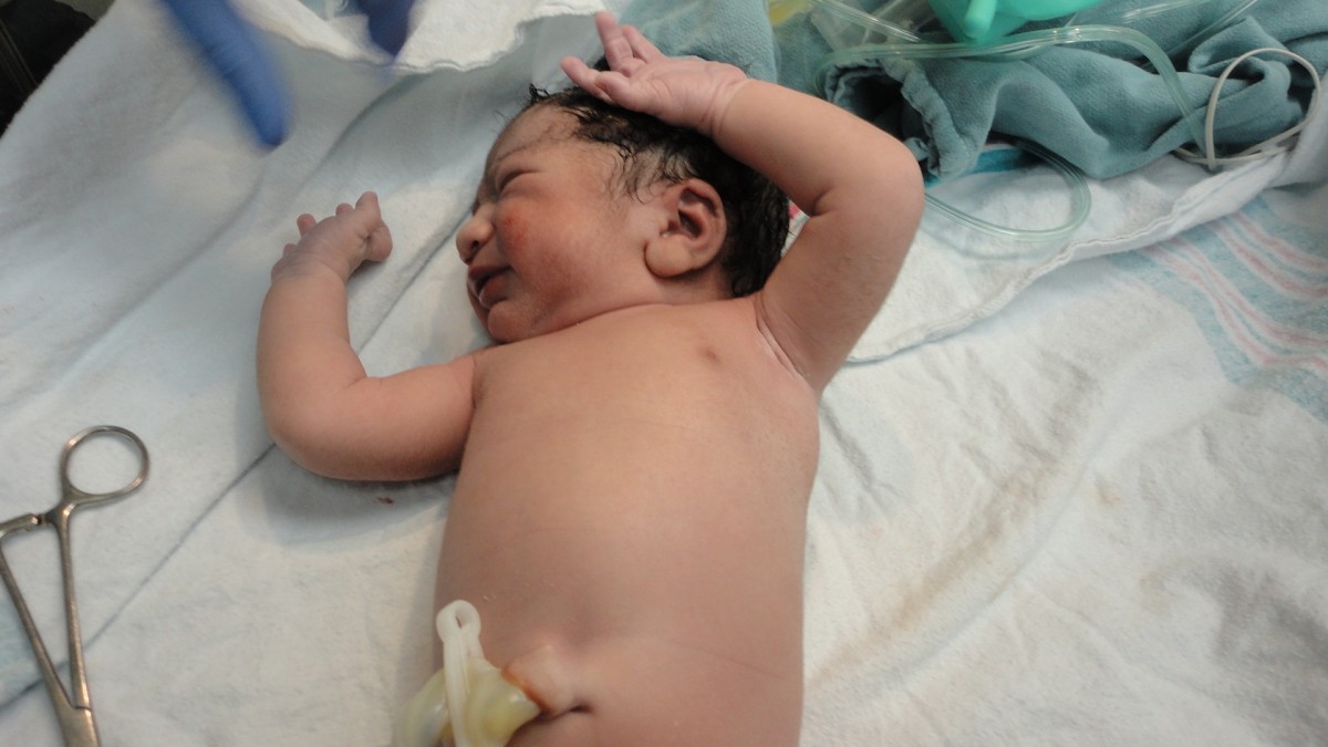 Newborn baby lies on hospital bed and stretches arms upwards.