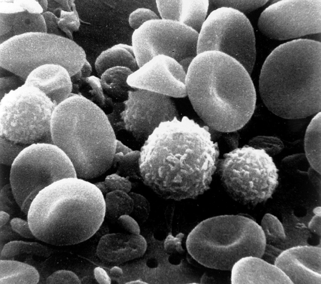 Magnified image of human blood cells, displayed in black and white.