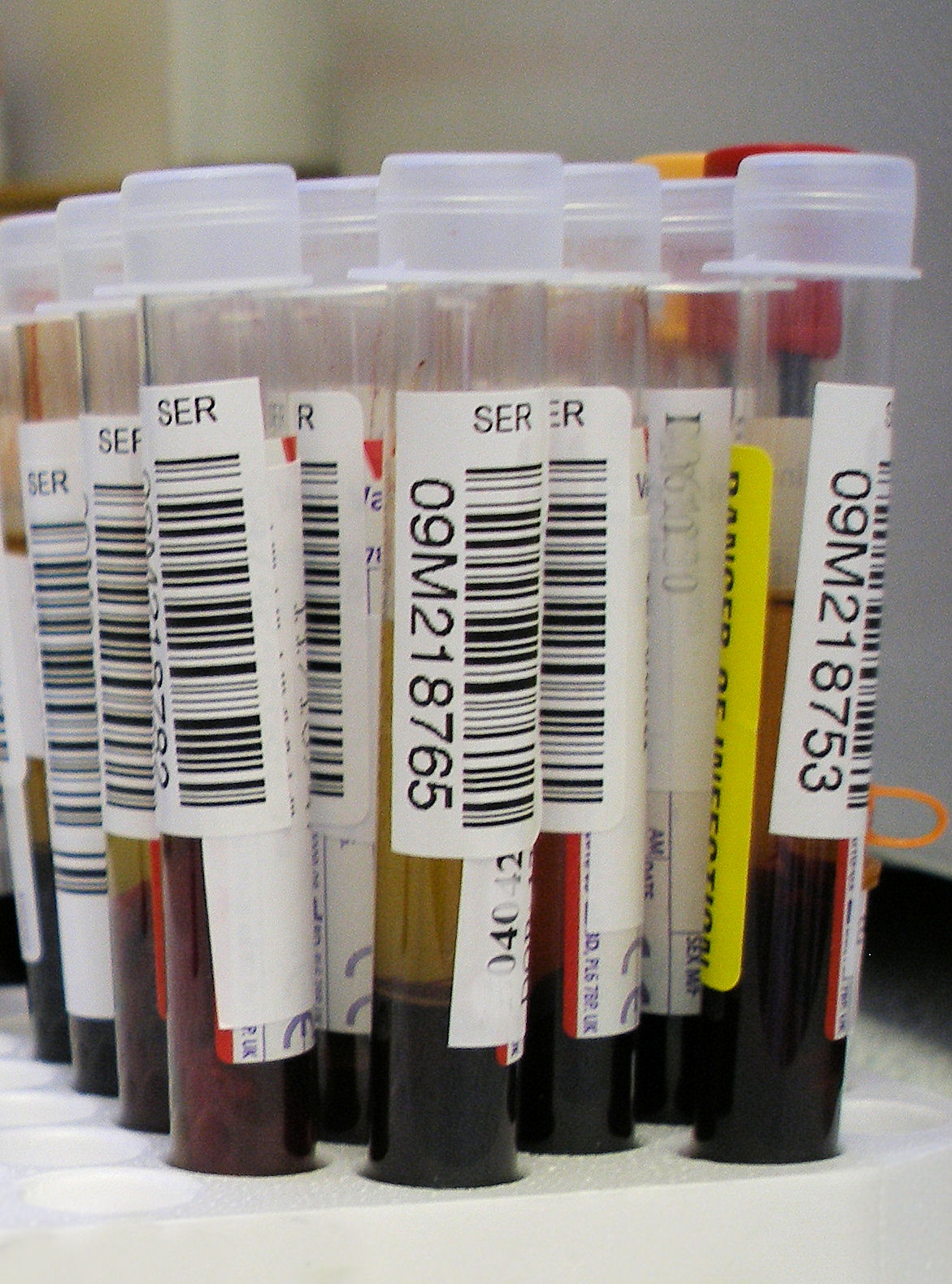 Tubes of human blood