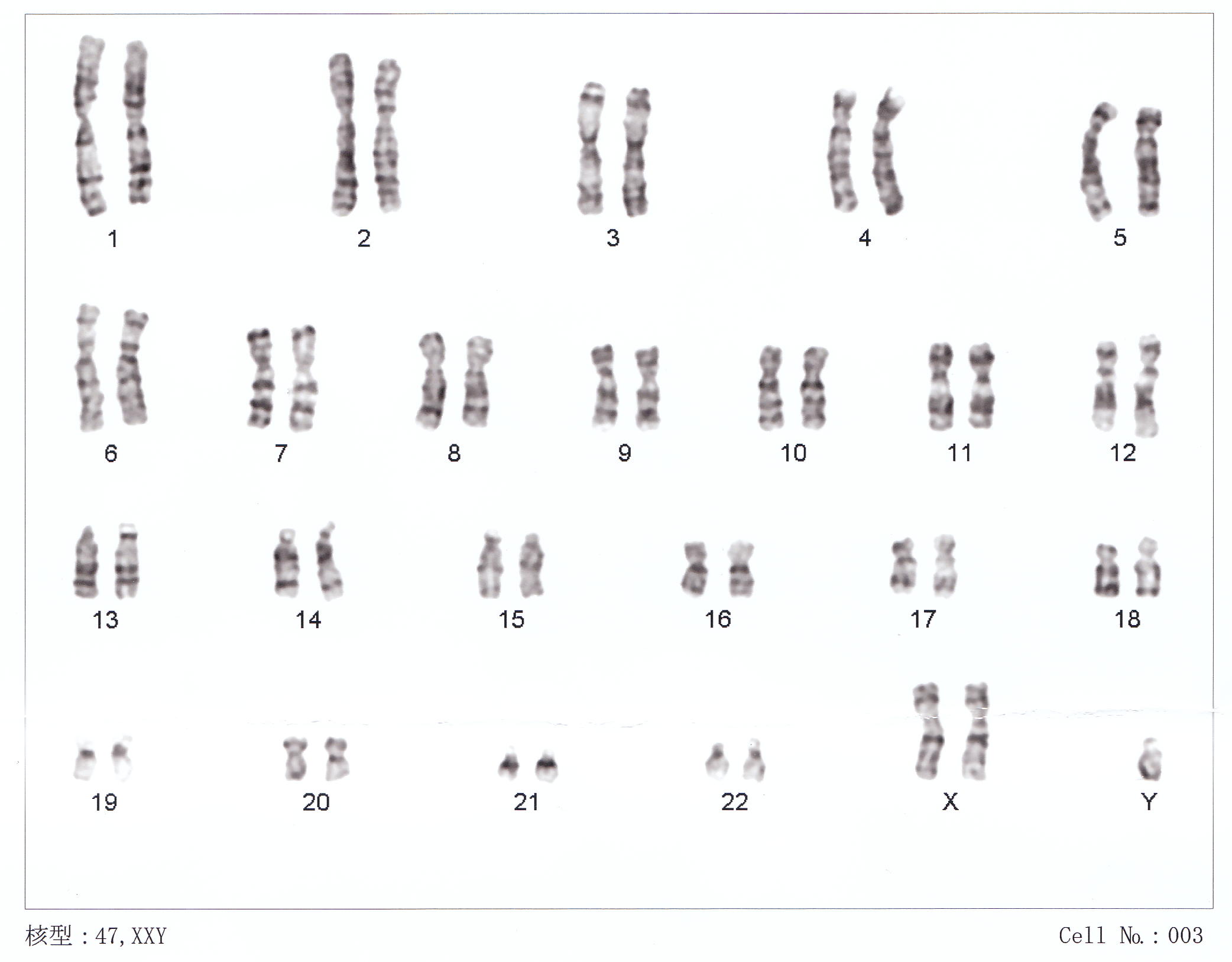 Four rows of all of the human chromosomes, labeled by number