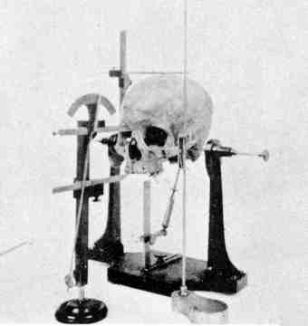 Measuring a skull