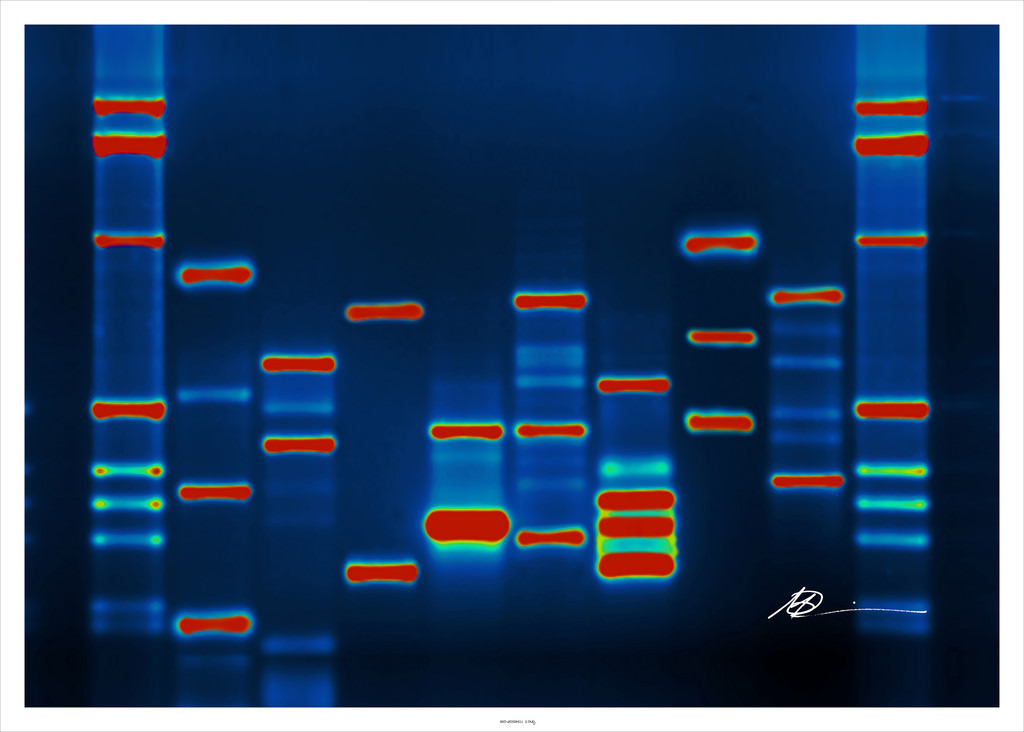 Red stained DNA markers