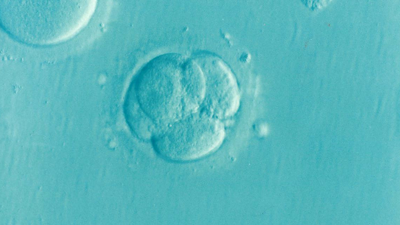 Human embryo 