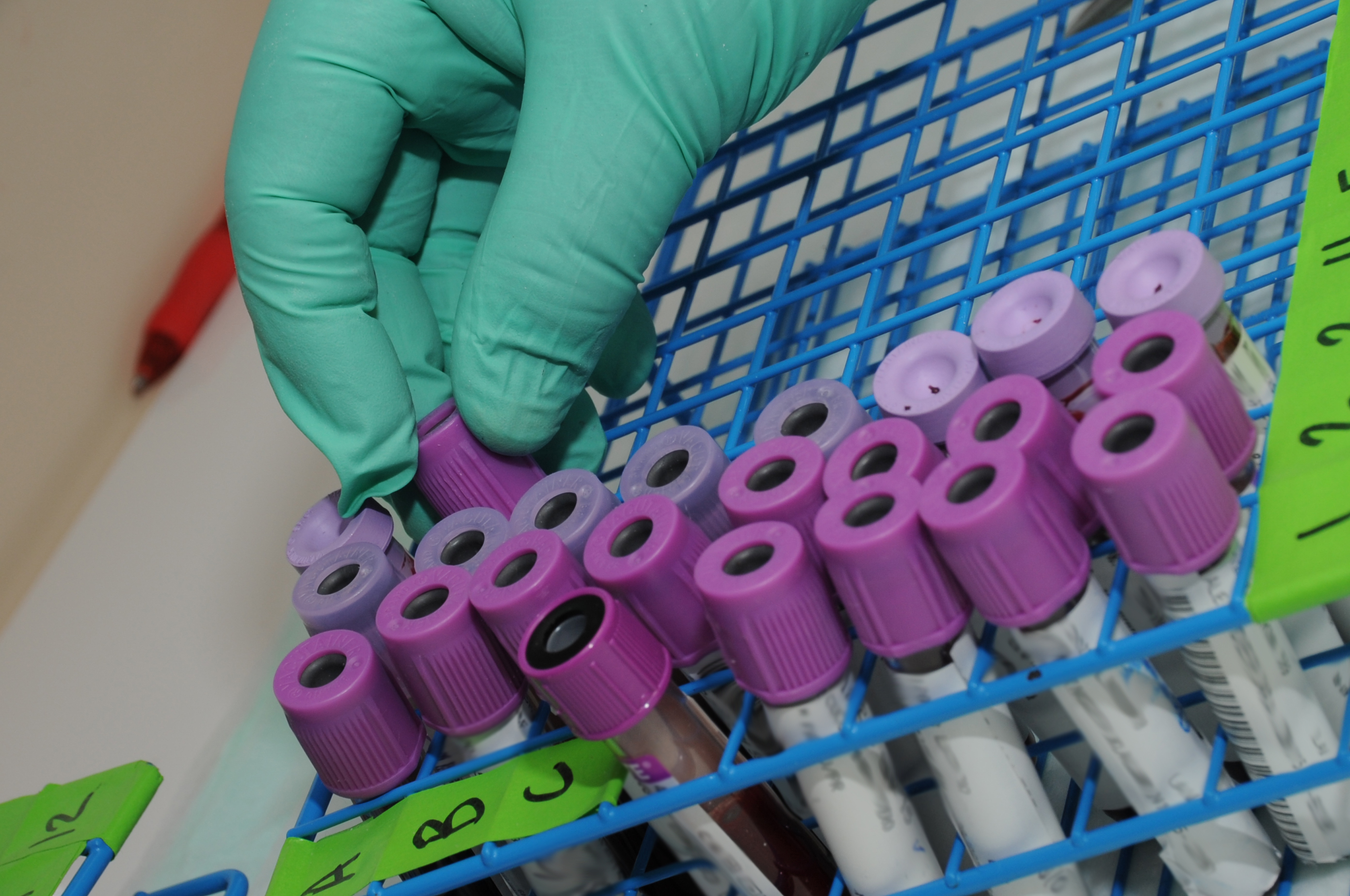 A hand wearing a green clinical glove holds purple test tubes containing DNA samples.