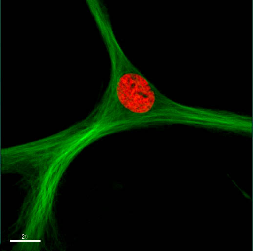 Microscopic image of a mesenchymal stem cell