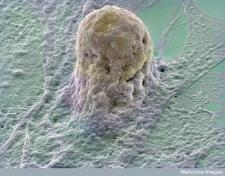 An embryonic stem cell