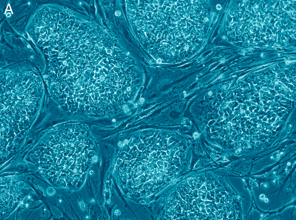 microscopic image of human embryonic stem cells