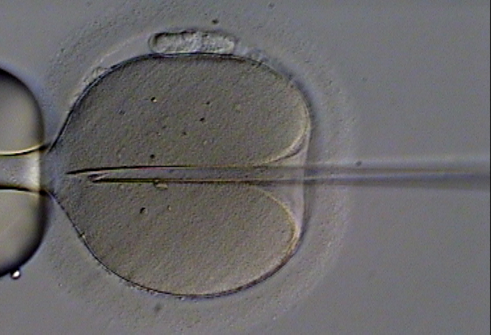 Microscopic image of in vitro fertilization procedure in which a single sperm is injected directly into an egg