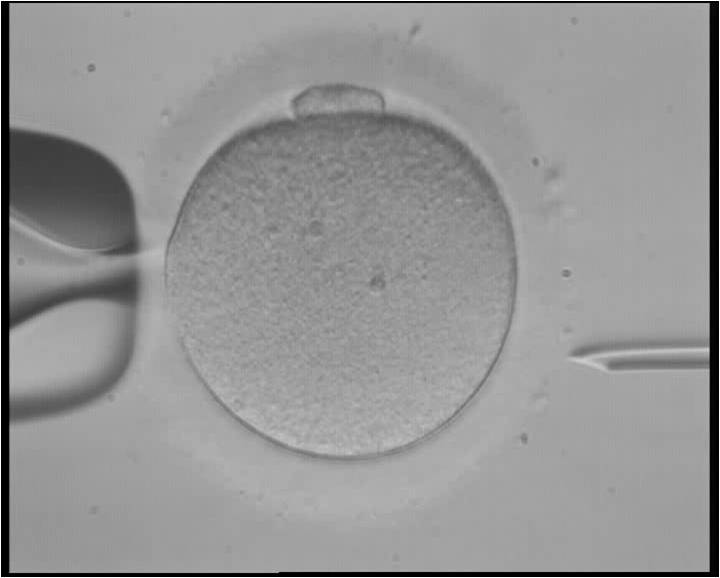 A grainy, grayscale image showing the process of Intracytoplasmic Sperm Injection (ICSI). A slender needle tip touching the edge of an egg, held by pipette.
