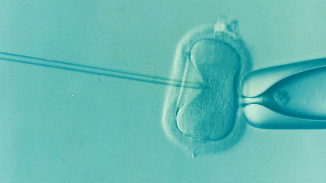 Microscopic image of sperm is injected directly into an egg