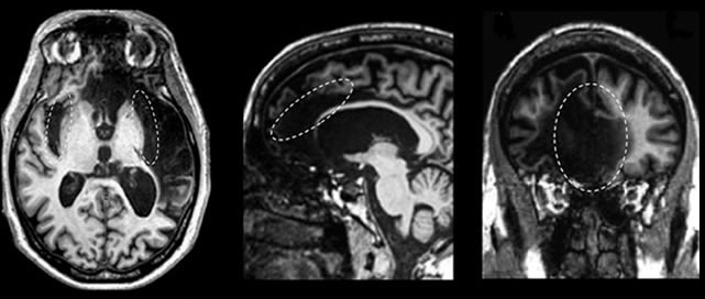 Three x-ray brain scans.