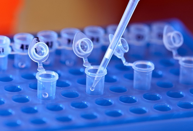 Pipetting fluid into clear test tubes held in a blue container.