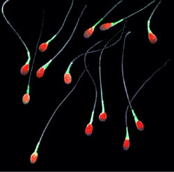 A colorized image of sperm