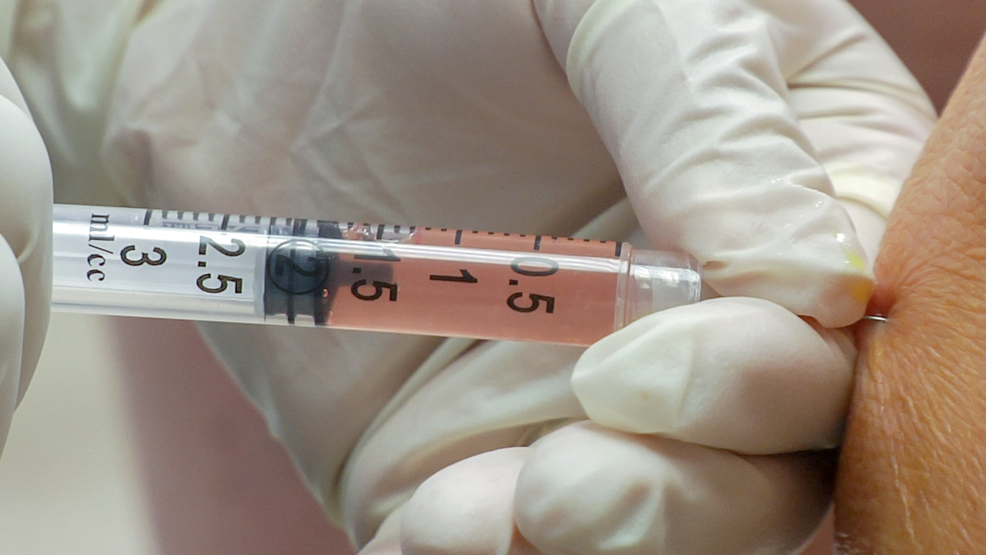 Stem cells in syringe being injected into knee