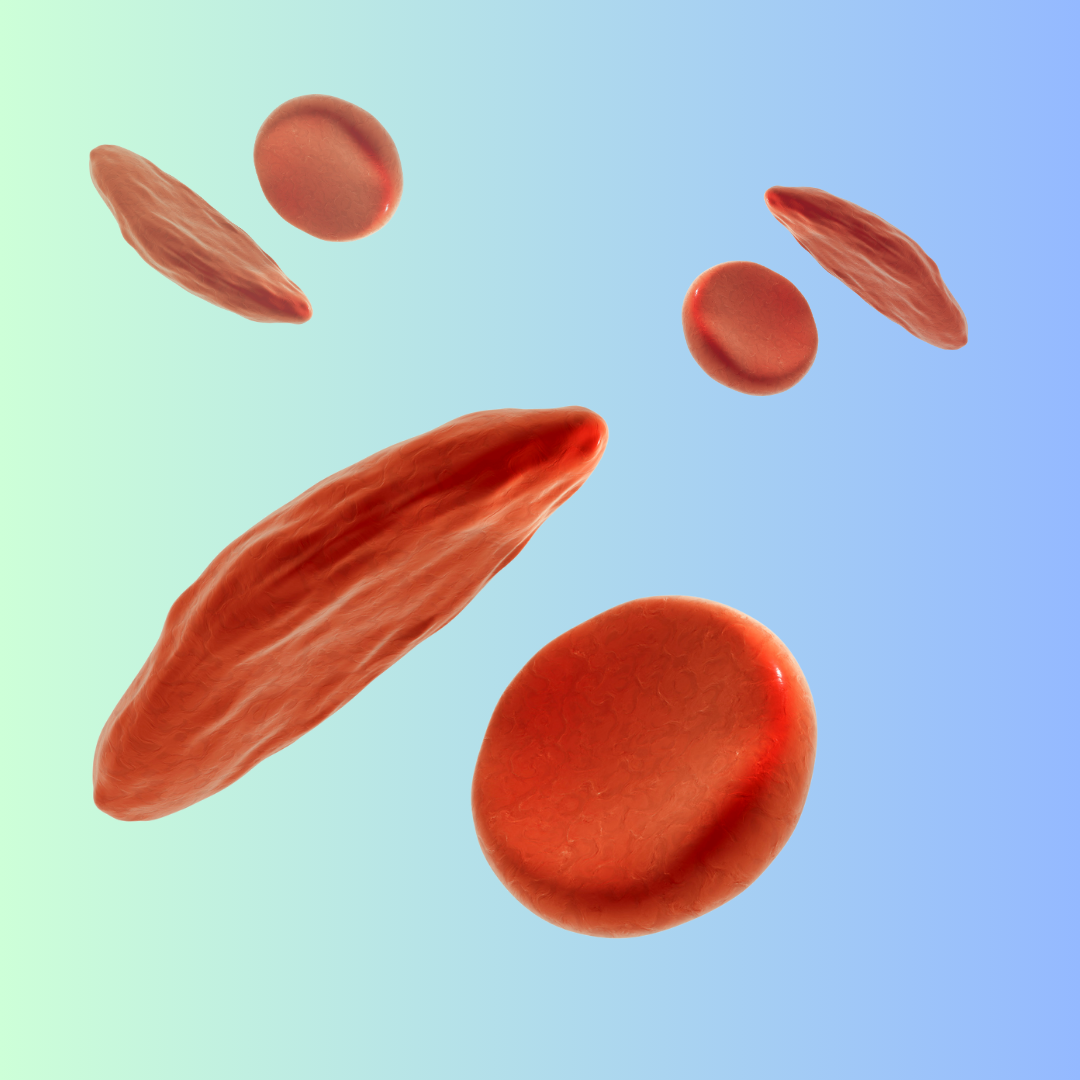 sickle cells