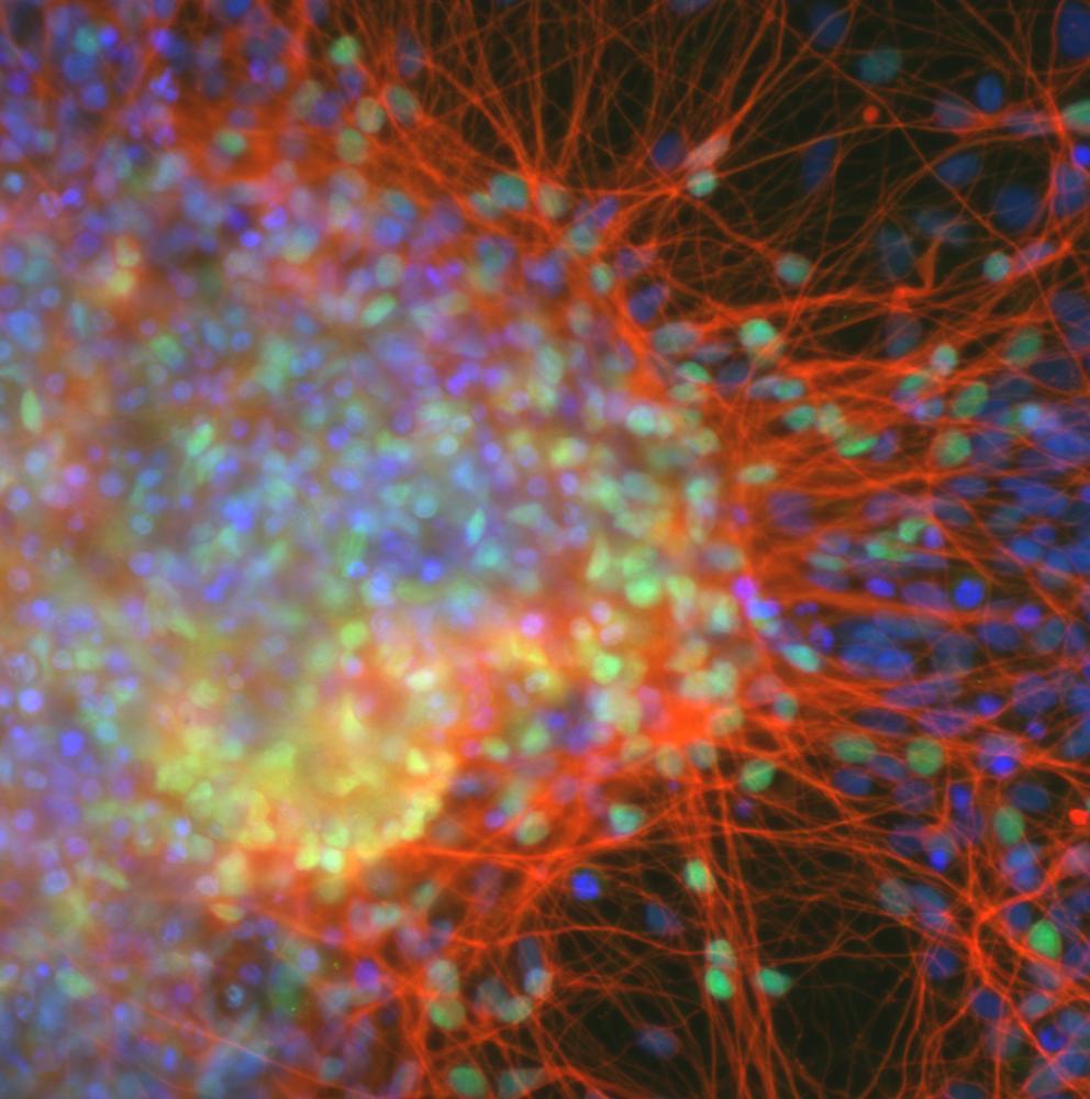 Image of neurons from stem cell, bright colors.