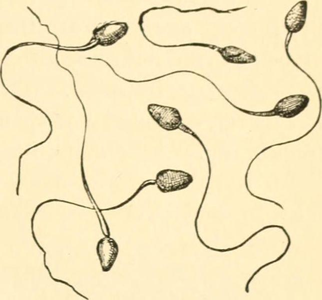 An old medical drawing shows 7 individual sperm overlapping one another.