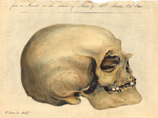 Image via Wikimedia: "Lithograph of a North American skull from Samuel Morton's Crania Americana, 1839. Morton believed that intelligence was correlated with brain size and varied between racial groups".