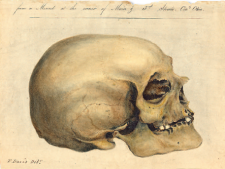 Image via Wikimedia: "Lithograph of a North American skull from Samuel Morton's Crania Americana, 1839. Morton believed that intelligence was correlated with brain size and varied between racial groups". Image via Wikimedia: "Lithograph of a North American skull from Samuel Morton's Crania Americana, 1839. Morton believed that intelligence was correlated with brain size and varied between racial groups".