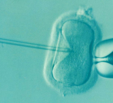 Turquoise microscopic image of human egg being injected with sperm with long needle in vitro