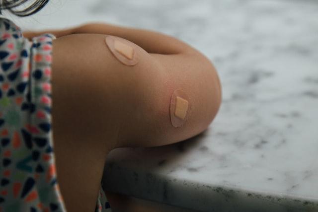 the arm of a child with two small bandaids on it