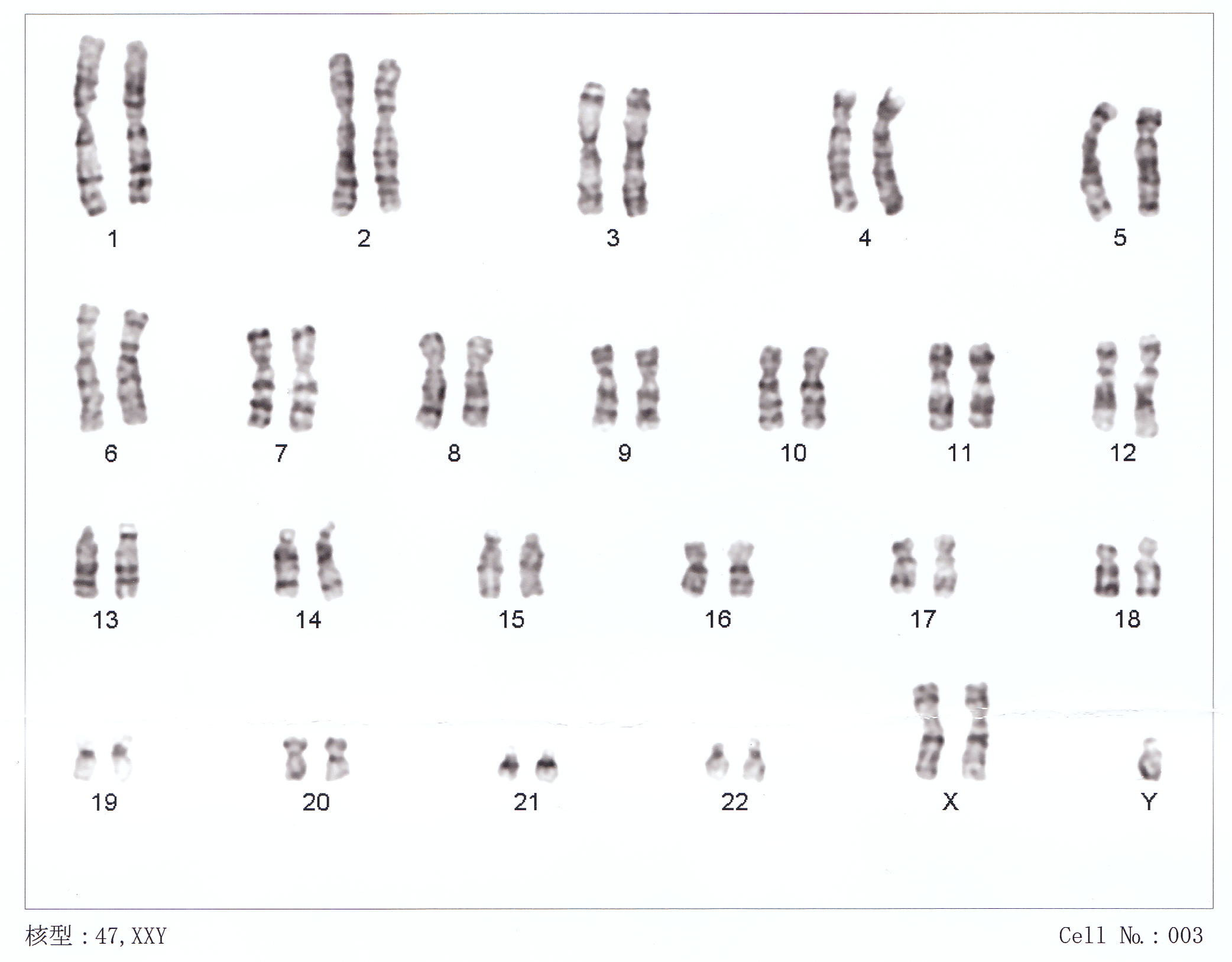 a display of all chromosomes