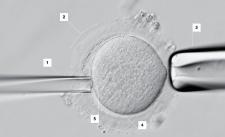 egg being used for IVF