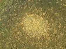 stem cells dyed yellow on a green background
