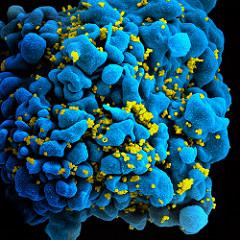 HIV particles (yellow) infecting host cell (blue)