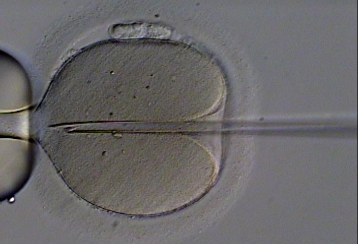 A human oocyte is held by a pipette, and another pipette containing an immobilized sperm is inserted through