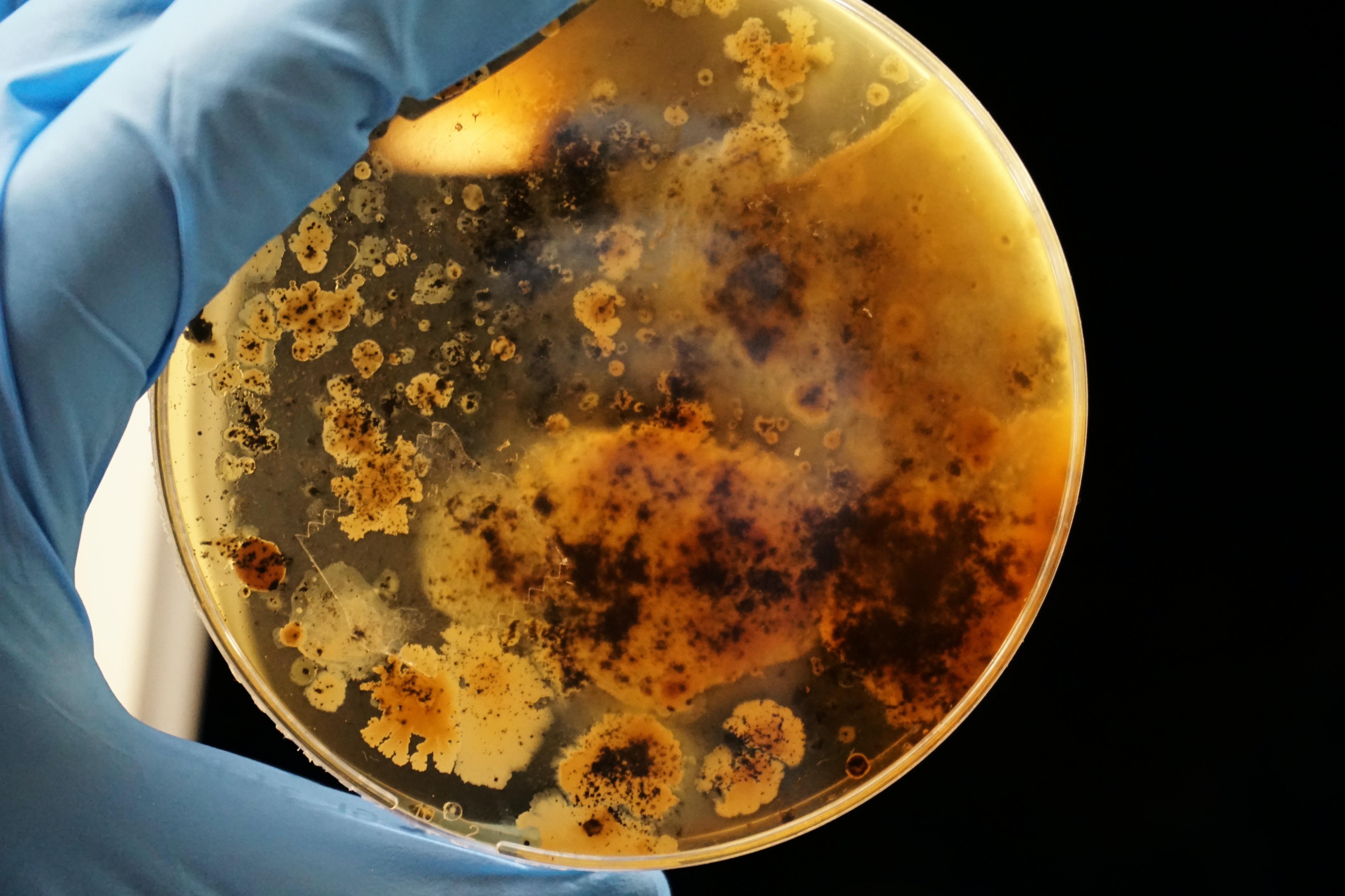 a blue-gloved hand holds up a petri dish mottled with shades of amber, orange, and black
