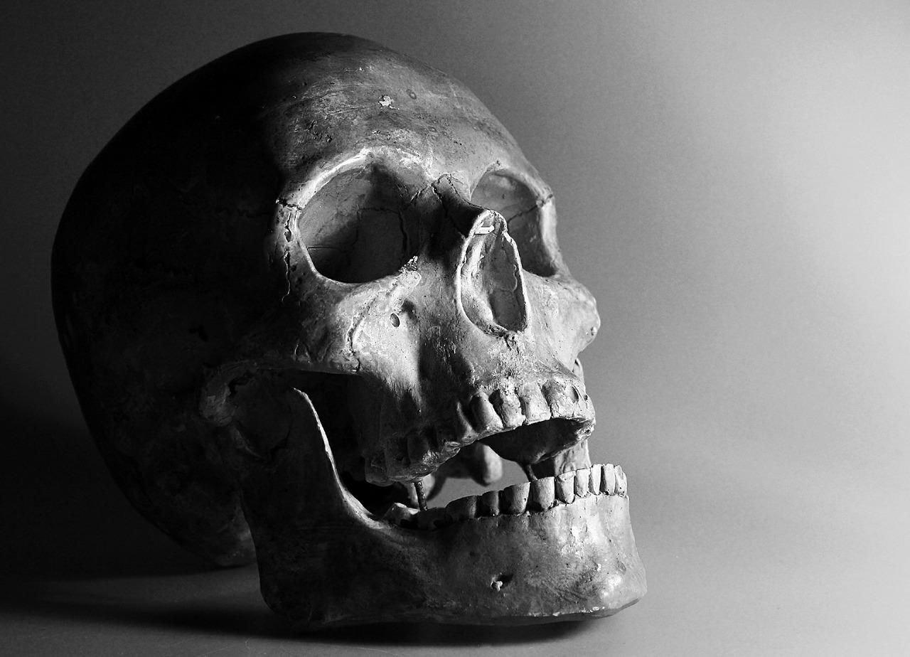 Black and white photo of human skull.