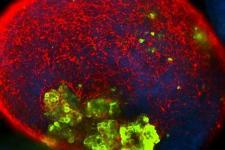 stem cells