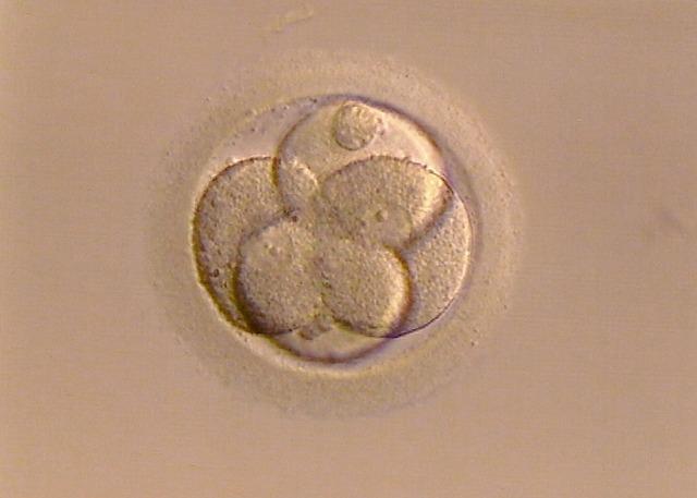 Image of a recently fertilized egg with few cells.