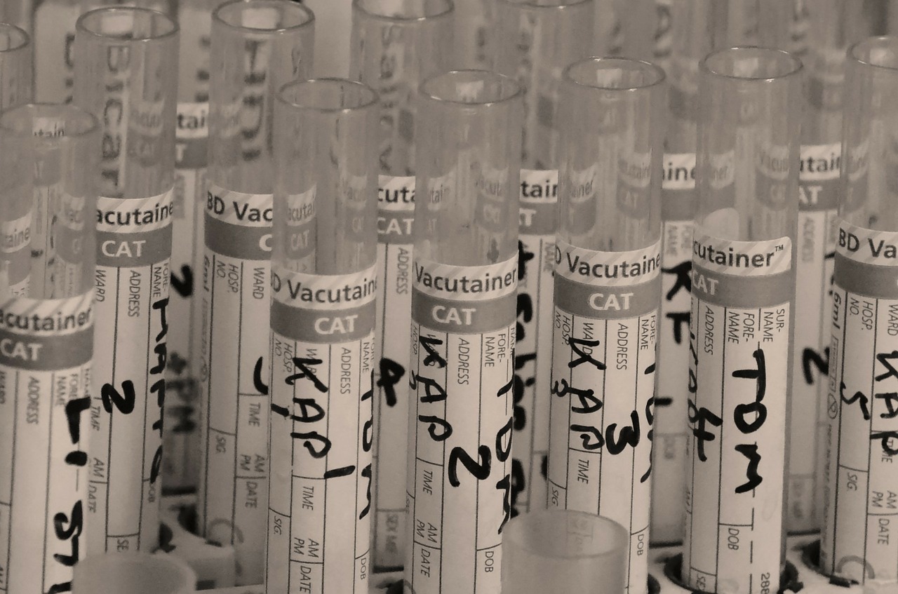 Labelled test tubes are placed on a rack.