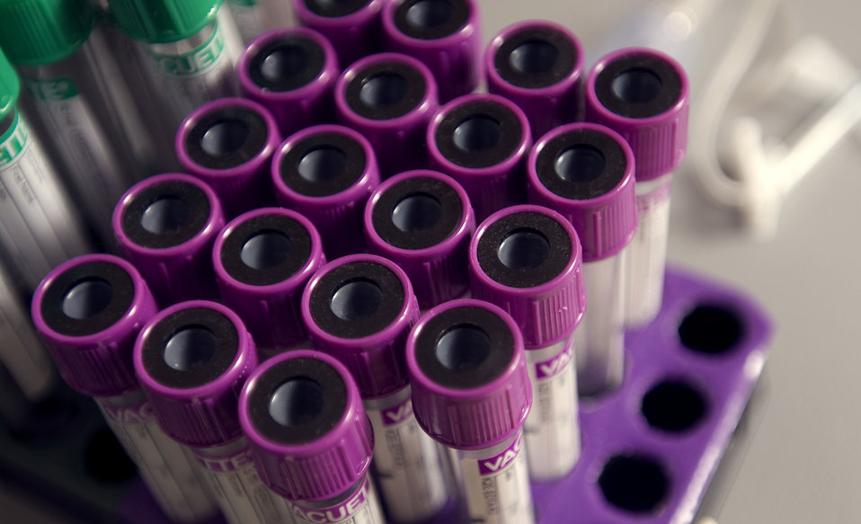 Tray of test tubes with purple caps.