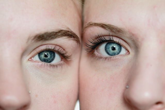 Twin's eyes